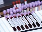 Какие анализы сдают «на рак»: лабораторная диагностика онкологических заболеваний Какой анализ крови может показать рак кишечника